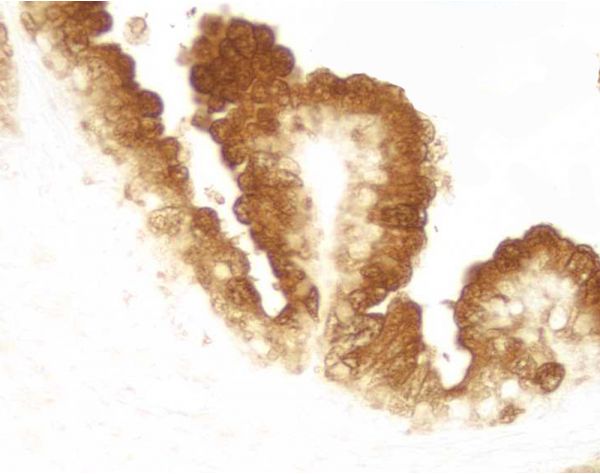 DAB Substrate Kit, Peroxidase (HRP), with Nickel, (3,3'-diaminobenzidine)