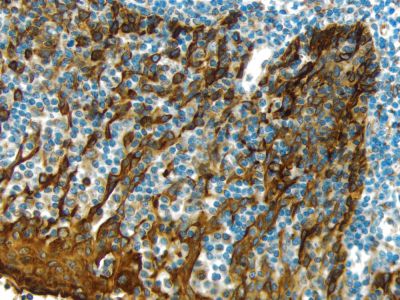 DAB Substrate Kit, Peroxidase (HRP), with Nickel, (3,3'-diaminobenzidine)