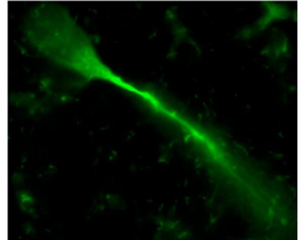 NEUROBIOTIN®-PLUS Tracer