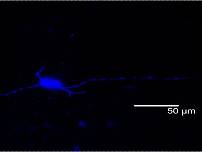 NEUROBIOTIN®-PLUS Tracer