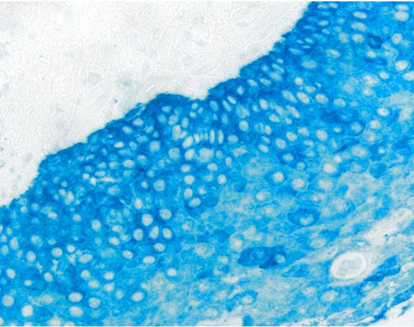 Vector® Blue Substrate Kit, Alkaline Phosphatase (AP)
