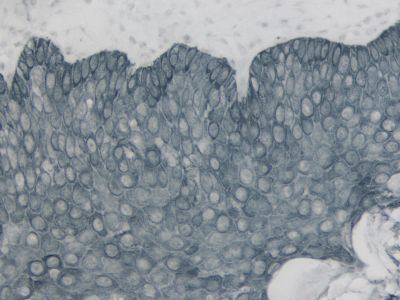 WestVision™ Peroxidase Polymer, Anti-Mouse IgG (Western Blot Detection)