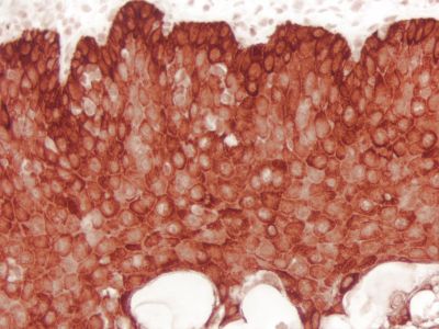 WestVision™ Peroxidase Polymer, Anti-Mouse IgG (Western Blot Detection)