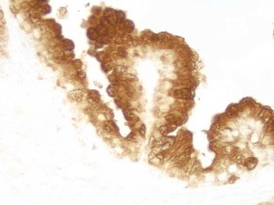 WestVision™ Peroxidase Polymer, Anti-Mouse IgG (Western Blot Detection)