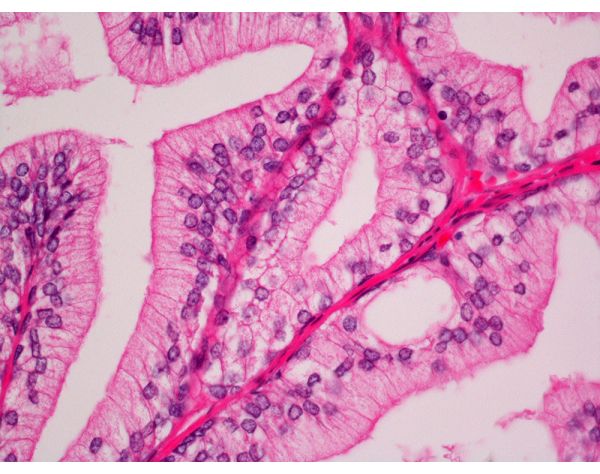 Hematoxylin and Eosin Stain Kit