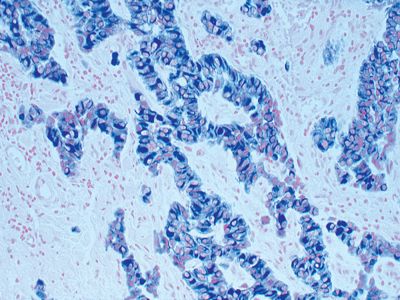 Hematoxylin and Eosin Stain Kit