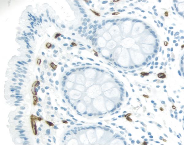 ImmPRESS® Excel Amplified Polymer Staining Kit, Anti-Mouse IgG, Peroxidase