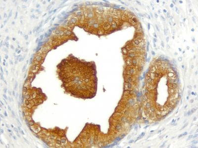 ImmPRESS® Excel Amplified Polymer Staining Kit, Anti-Mouse IgG, Peroxidase
