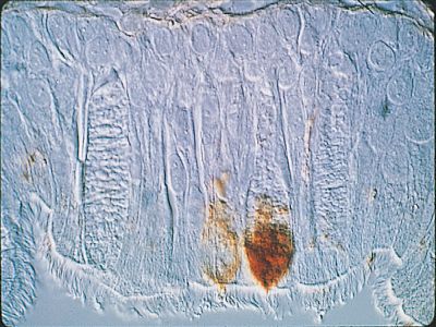 Peanut Agglutinin (PNA), Rhodamine
