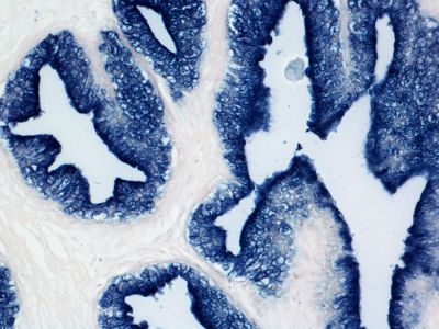 Streptavidin, Alkaline Phosphatase