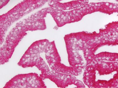 Streptavidin, Alkaline Phosphatase