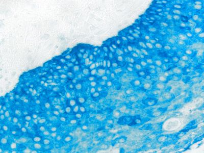Streptavidin, Alkaline Phosphatase