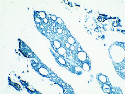 Streptavidin, Peroxidase, ELISA Grade (Concentrate, for ELISAs and Blots)