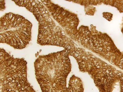 Streptavidin, Peroxidase (Concentrate, for IHC)