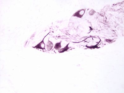 Streptavidin, Peroxidase (Concentrate, for IHC)