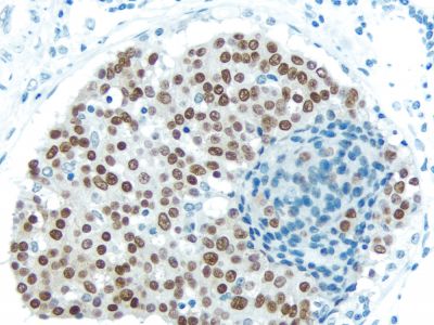 Rabbit IgG, Control Antibody