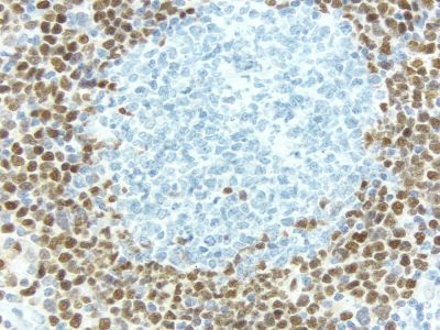 Rabbit IgG, Control Antibody