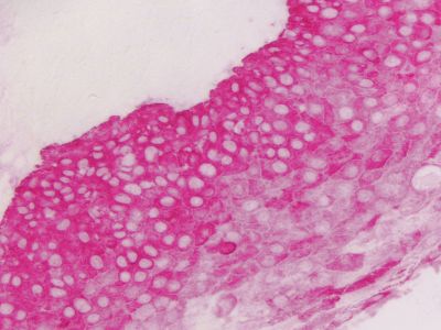 VECTASTAIN® ABC-AP Kit, Alkaline Phosphatase (Rat IgG)