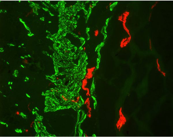 M.O.M.® (Mouse on Mouse) Immunodetection Kit, Fluorescein