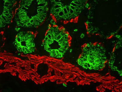 M.O.M.® (Mouse on Mouse) Immunodetection Kit, Fluorescein