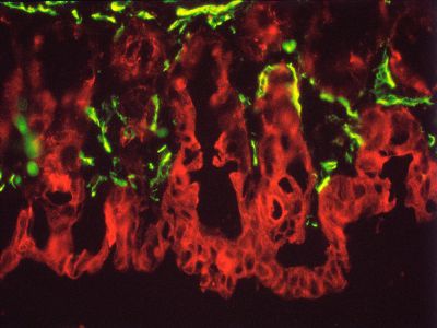 M.O.M.® (Mouse on Mouse) Immunodetection Kit, Fluorescein