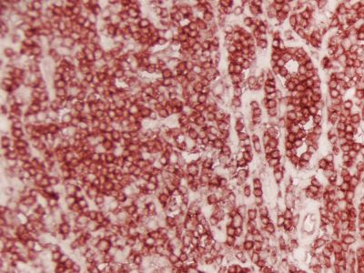 Goat Anti-Rat IgG, Mouse Adsorbed, Antibody (H+L), Peroxidase