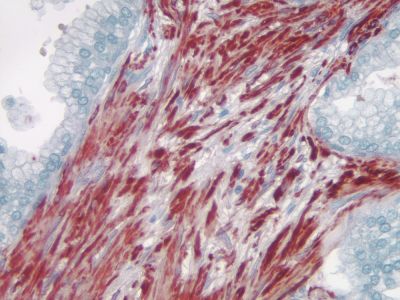 Goat Anti-Rat IgG, Mouse Adsorbed, Antibody (H+L), Peroxidase