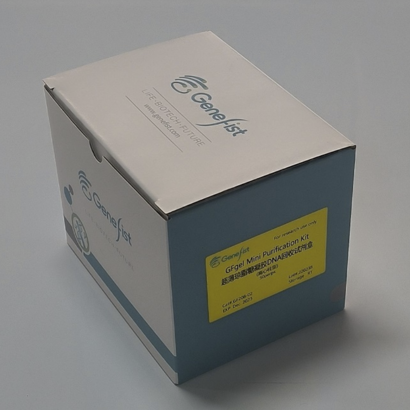 超薄琼脂糖凝胶DNA回收试剂盒